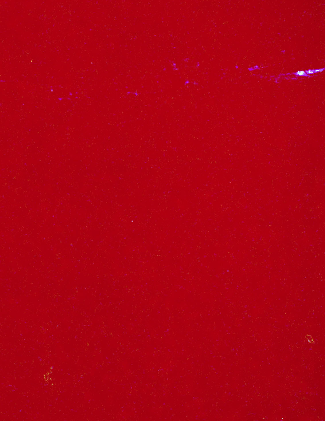 Filmburn Simon Abele